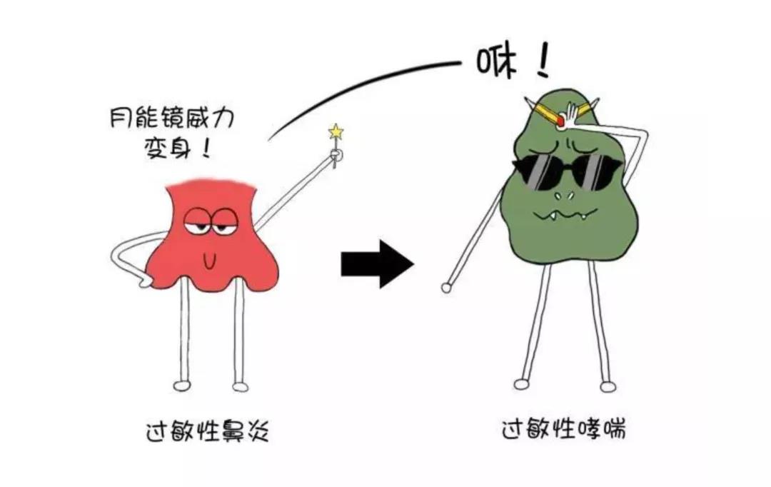 过敏性鼻炎