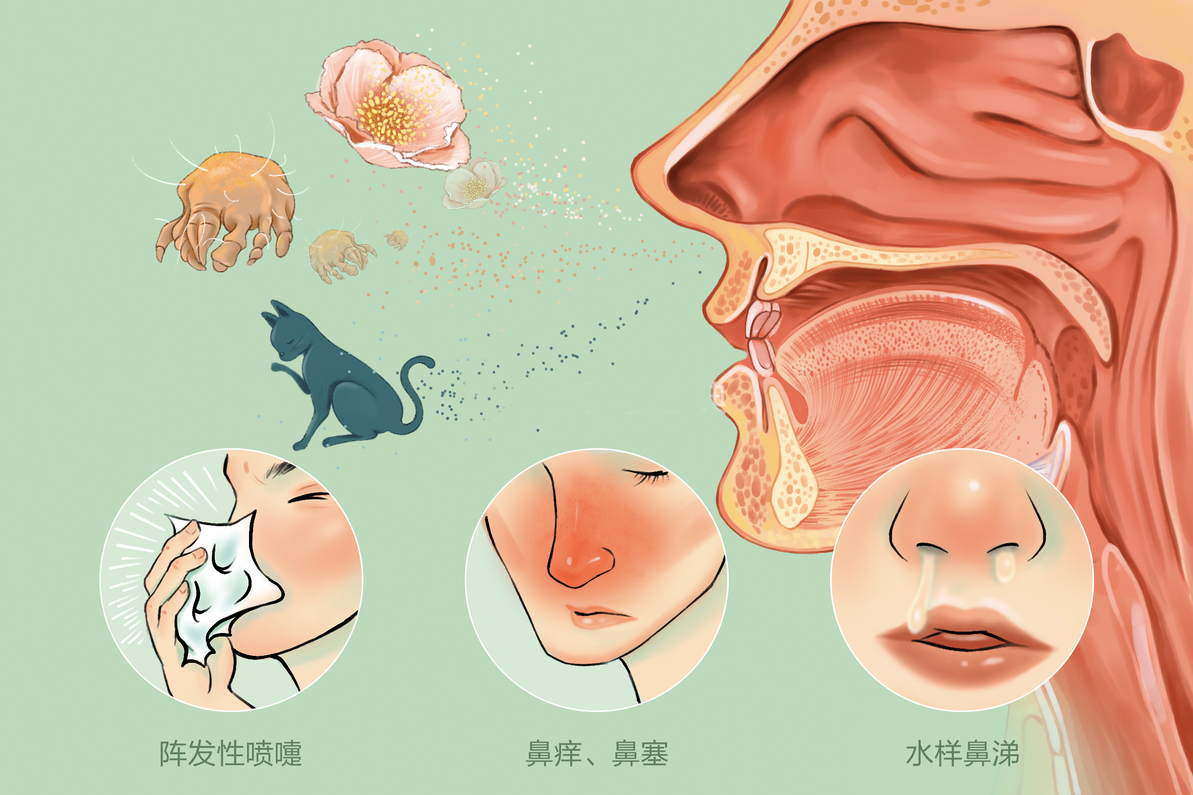 重庆过敏性鼻炎